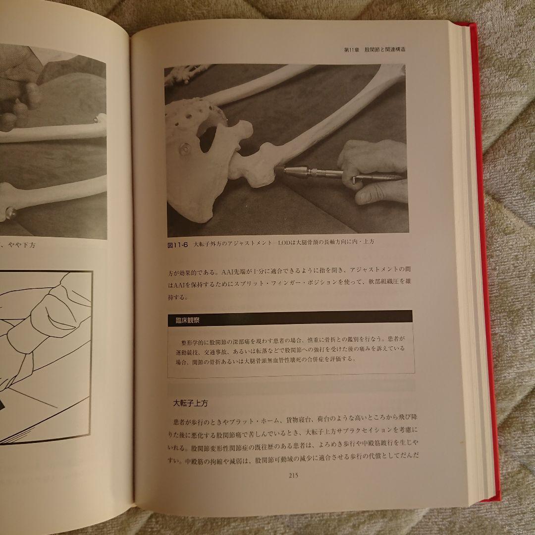 アクティベータ・メソッド カイロプラクティック・テクニック