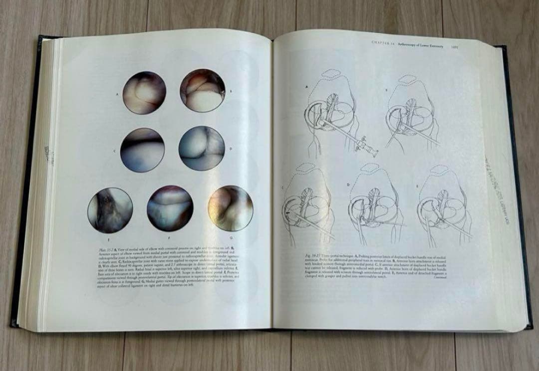 Campbell's Operative Orthopaedics 医学書　洋書