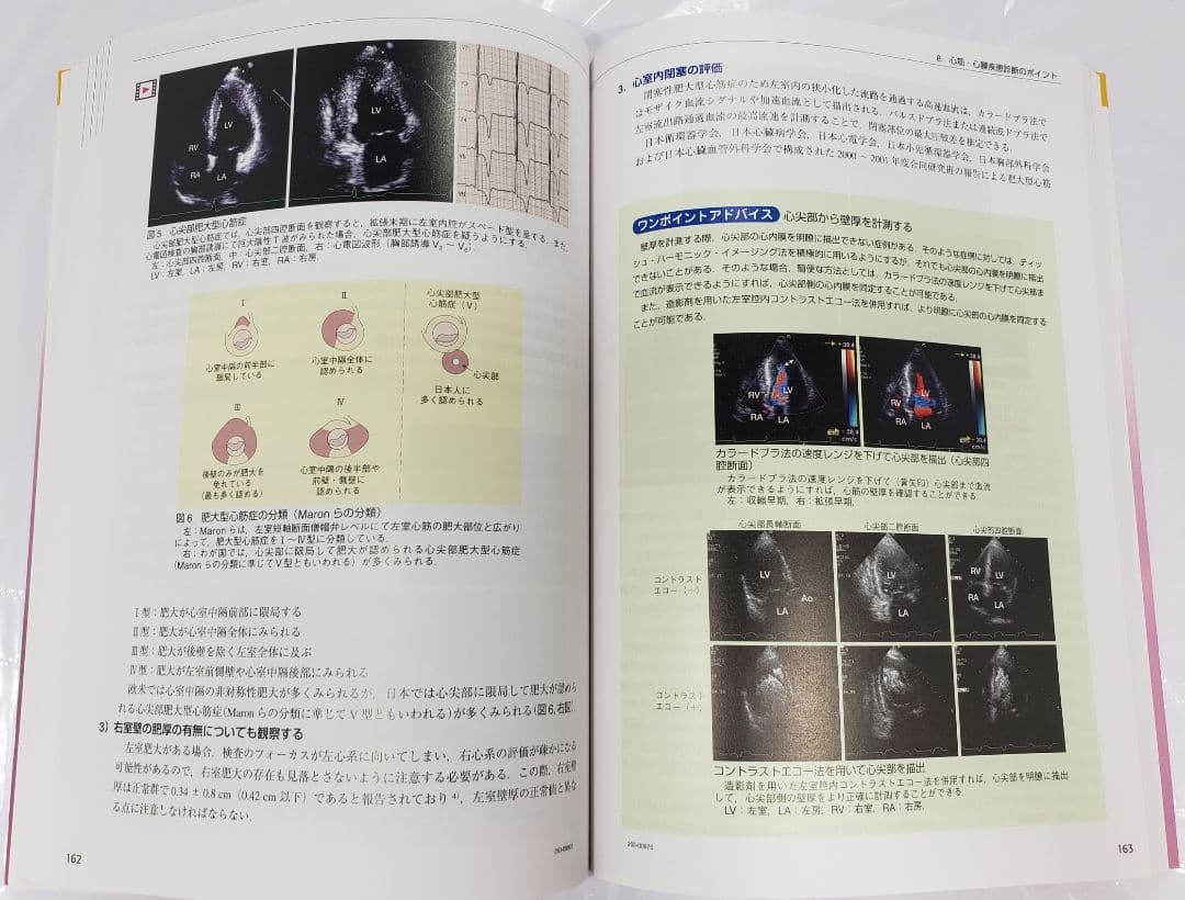 心臓超音波テキスト